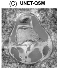 Zum Artikel "Neues Papier: Deep learning–based quantitative susceptibility mapping (QSM) in the presence of fat using synthetically generated multi-echo phase training data"