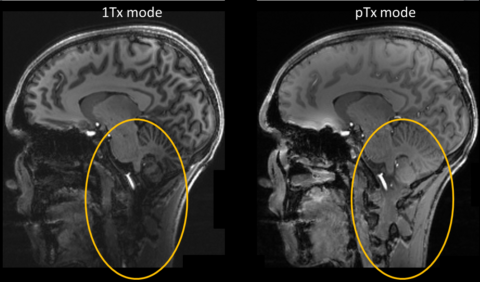 xMRI Lab (Nagel) - MRT-Forschung am Universitätsklinikum Erlangen