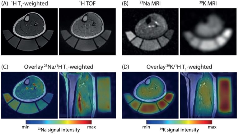 New paper: Assessing muscle-specific potassium concentrations in human lower leg using potassium magnetic resonance imaging