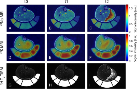 Zum Artikel "Neues Papier: MRI of Potassium and Sodium Enables Comprehensive Analysis of Ion Perturbations in Skeletal Muscle Tissue After Eccentric Exercise"