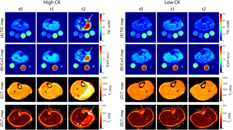 New paper: Sodium and quantitative hydrogen parameter changes in muscle tissue after eccentric exercise and in delayed-onset muscle soreness assessed with magnetic resonance imaging