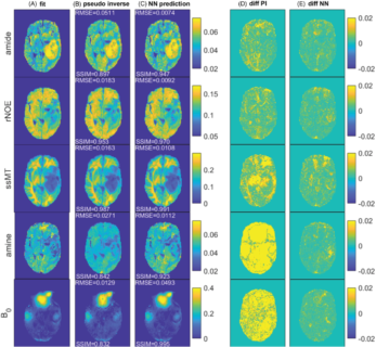 Zum Artikel "Neues Papier: DeepCEST 7 T: Fast and homogeneous mapping of 7 T CEST MRI parameters and their uncertainty quantification"