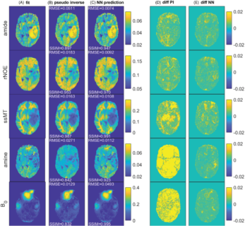 Zum Artikel "Editor’s Pick: DeepCEST 7 T: Fast and homogeneous mapping of 7 T CEST MRI parameters and their uncertainty quantification"