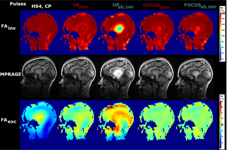 Neues Papier: The effects of RF coils and SAR supervision strategies for clinically applicable nonselective parallel-transmit pulses at 7 T