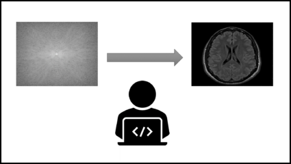 Zur Seite: Kurs „Computational MRI“