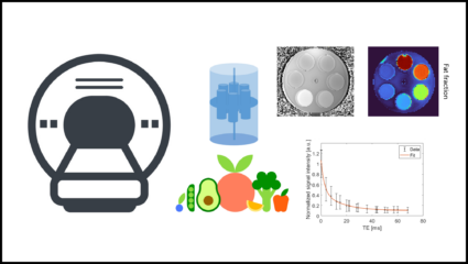 To the page:Lab course experiment „Magnetic Resonance Imaging“