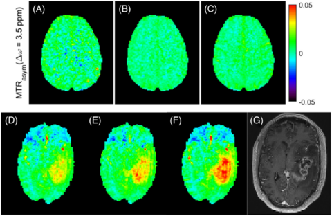 Zum Artikel "Neues Papier: Snapshot CEST++: Advancing rapid whole-brain APTw-CEST MRI at 3 T"