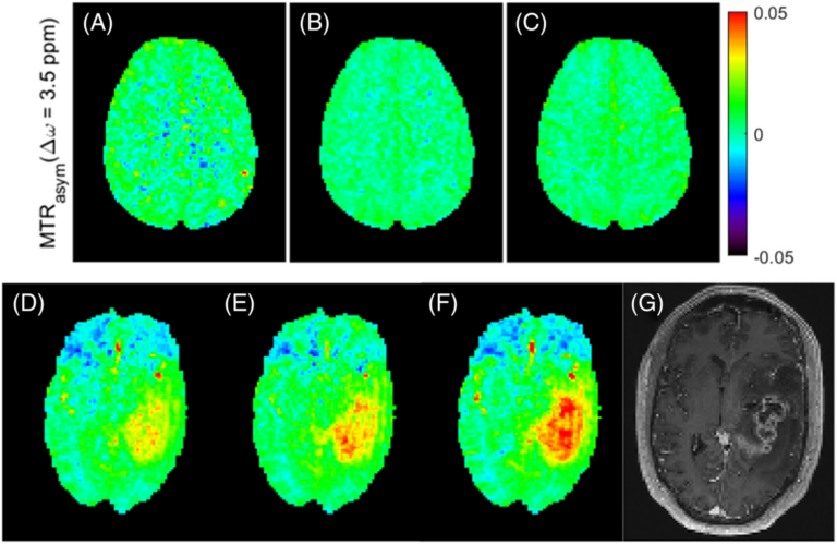 New paper: Snapshot CEST++: Advancing rapid whole-brain APTw-CEST MRI at 3 T