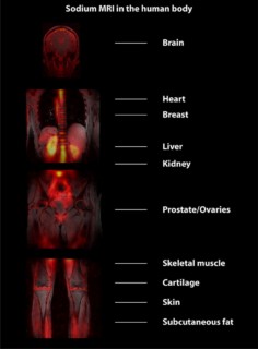 Zum Artikel "Neuer Review: Recent technical developments and clinical research -applications of sodium (23Na) MRI"