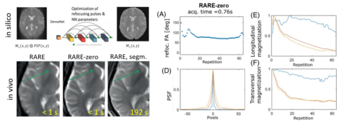 Zum Artikel "Neues Papier: MR-zero meets RARE MRI: Joint optimization of refocusing flip angles and neural networks to minimize T2-induced blurring in spin echo sequences"