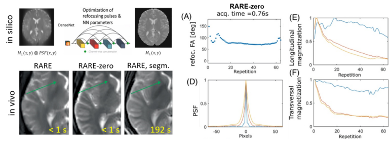 New paper: MR-zero meets RARE MRI: Joint optimization of refocusing flip angles and neural networks to minimize T2-induced blurring in spin echo sequences