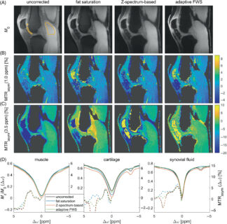 Zum Artikel "New paper: Multi-echo–based fat artifact correction for CEST MRI at 7 T"