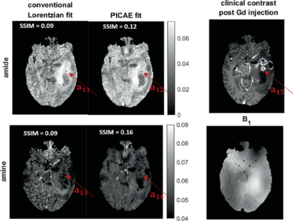 Zum Artikel "New paper: Physics-Informed Conditional Autoencoder Approach for Robust Metabolic CEST MRI at 7T"