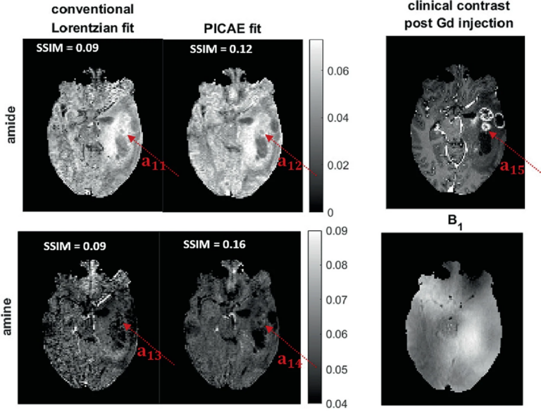 Neues Paper: Physics-Informed Conditional Autoencoder Approach for Robust Metabolic CEST MRI at 7T