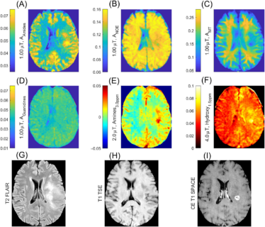 Zum Artikel "Neues Paper: Comprehensive 7 T CEST: A clinical MRI protocol covering multiple exchange rate regimes"