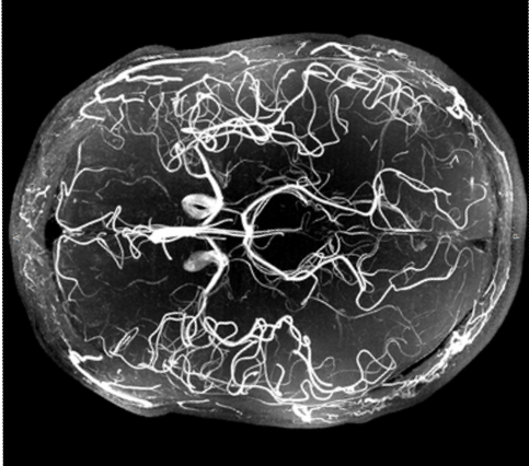 Zur Seite: xMRI Lab (Nagel)