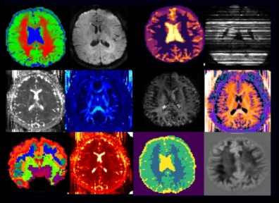 Zur Seite: sMRI Lab (Hutter)