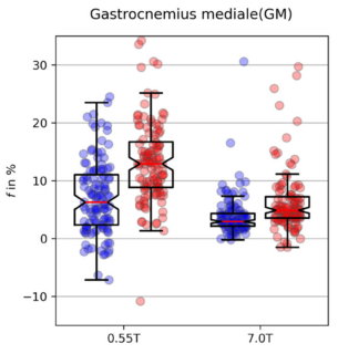 Zum Artikel "Neues Paper: Influence of Magnetic Field Strength on Intravoxel Incoherent Motion Parameters in Diffusion MRI of the Calf"
