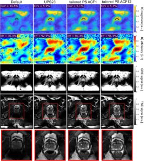 Zum Artikel "New paper: Accelerated B1+ mapping and robust parallel transmit pulse design for heart and prostate imaging at 7T"