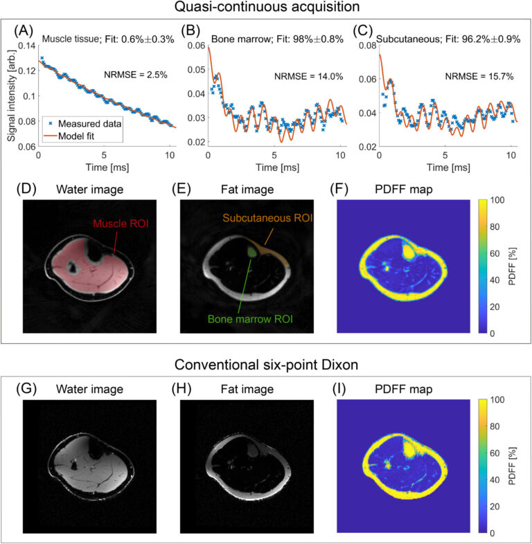 New Paper: Fat/Water Separation at 7 T Using a 3D Radial Sequence With Quasi-Continuous Echo Times