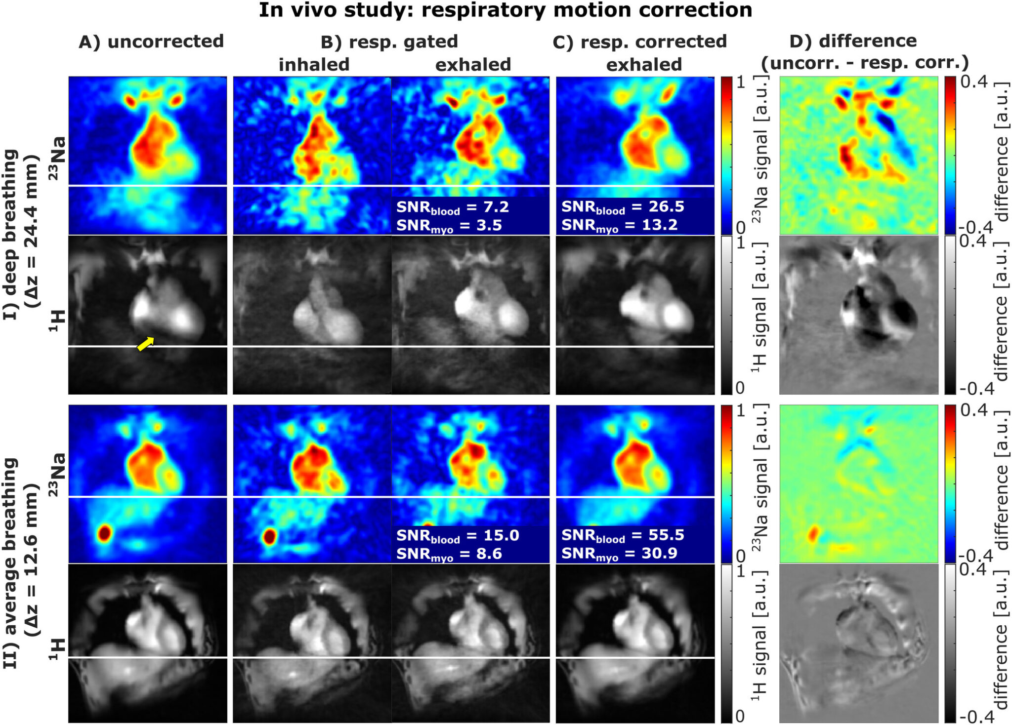New Paper: Improved Myocardial Sodium Quantification at 7 T Using ...