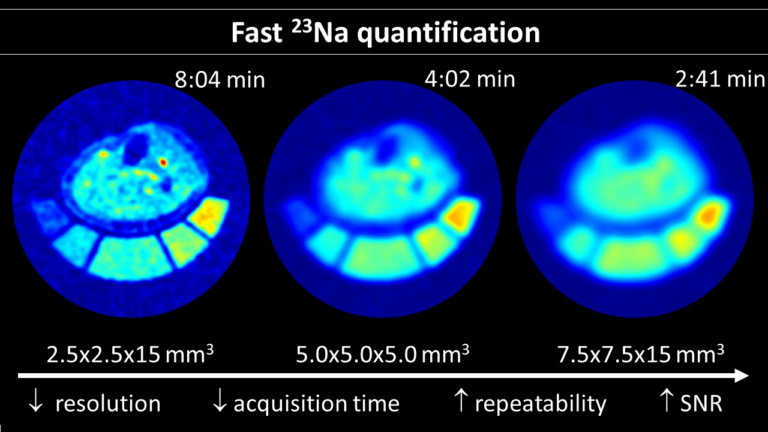 Neues Paper: Quantification of the Tissue Sodium Concentration in the Human Calf at 7T With Reduced Acquisition Time: Influence of the Nominal Spatial Resolution